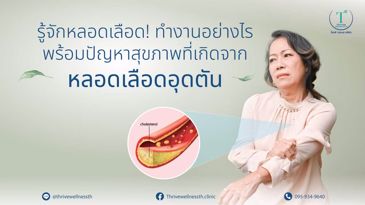 Chelation Therapy คีเลชั่นที่ Thrive Wellness Clinic กรุงเทพ